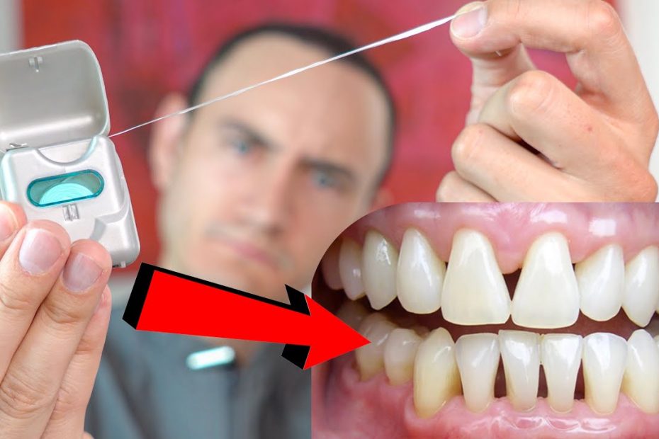 Todo lo que necesitas saber sobre el hilo dental atascado entre los dientes