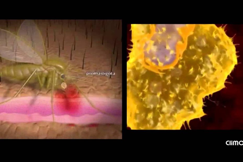 Síntomas tempranos de la leishmaniasis: Guía para identificarlos
